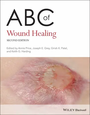 ABC de la curación de heridas - ABC of Wound Healing