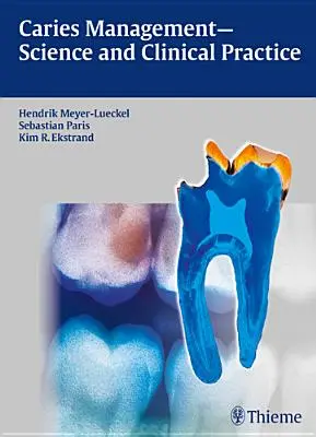 Tratamiento de la caries: ciencia y práctica clínica - Caries Management - Science and Clinical Practice