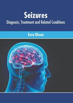 Convulsiones: Diagnóstico, Tratamiento y Condiciones Relacionadas - Seizures: Diagnosis, Treatment and Related Conditions