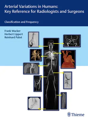 Variaciones Arteriales en Humanos: Referencia Clave para Radiólogos y Cirujanos: Clasificaciones y frecuencia - Arterial Variations in Humans: Key Reference for Radiologists and Surgeons: Classifications and Frequency