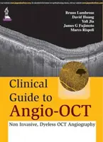 Guía clínica de Angio-OCT: Angiografía OCT no invasiva y sin contraste - Clinical Guide to Angio-OCT: Non Invasive, Dyeless OCT Angiography