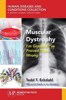 Distrofia muscular: Agradezco haber demostrado que se equivocaban - Muscular Dystrophy: I'm Grateful I've Proved Them Wrong