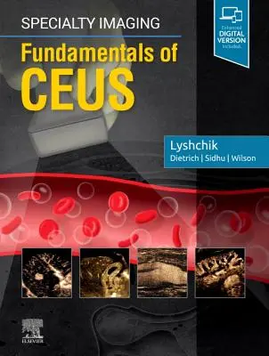 Imagen especializada: Fundamentos de Ceus - Specialty Imaging: Fundamentals of Ceus