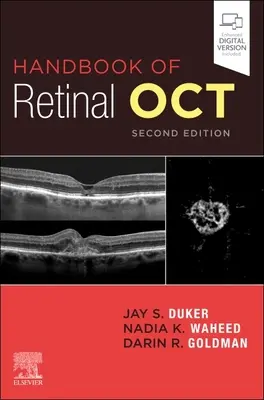 Manual de Retina Oct: Tomografía de coherencia óptica - Handbook of Retinal Oct: Optical Coherence Tomography