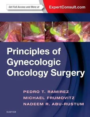 Principios de cirugía oncológica ginecológica - Principles of Gynecologic Oncology Surgery