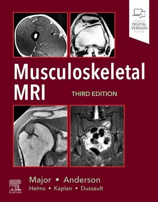 Resonancia magnética musculoesquelética - Musculoskeletal MRI