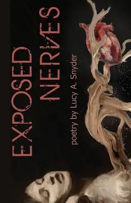 Nervios Expuestos - Exposed Nerves