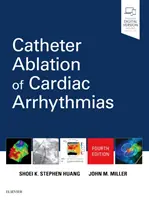 Ablación por catéter de las arritmias cardíacas - Catheter Ablation of Cardiac Arrhythmias