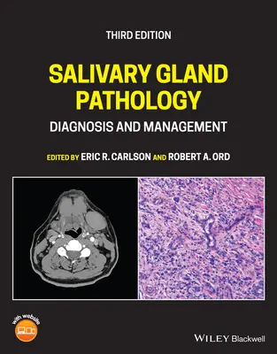 Patología de las glándulas salivales: Diagnóstico y manejo - Salivary Gland Pathology: Diagnosis and Management