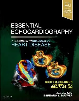 Ecocardiografía esencial: A Companion to Braunwald's Heart Disease (Ecocardiografía esencial: complemento de la enfermedad cardíaca de Braunwald) - Essential Echocardiography: A Companion to Braunwald's Heart Disease