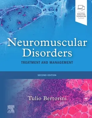 Trastornos neuromusculares: Treatment and Management - Neuromuscular Disorders: Treatment and Management