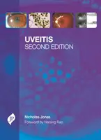 Uveítis - Uveitis