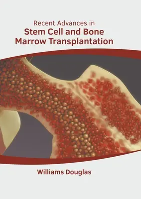 Avances recientes en el trasplante de células madre y médula ósea - Recent Advances in Stem Cell and Bone Marrow Transplantation