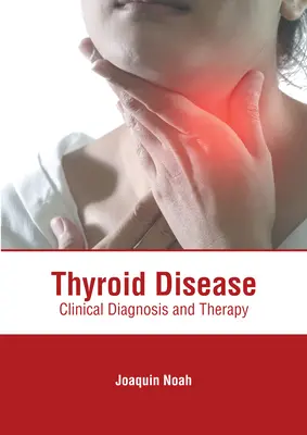 Enfermedad tiroidea: Diagnóstico clínico y terapia - Thyroid Disease: Clinical Diagnosis and Therapy