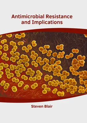 Resistencia a los antimicrobianos e implicaciones - Antimicrobial Resistance and Implications