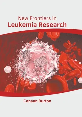 Nuevas fronteras en la investigación de la leucemia - New Frontiers in Leukemia Research