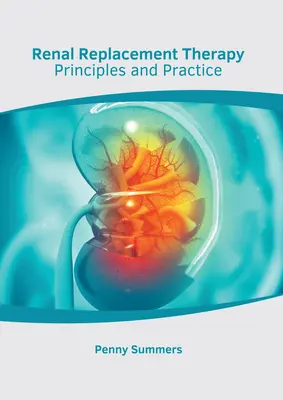 Terapia renal sustitutiva: Principios y práctica - Renal Replacement Therapy: Principles and Practice