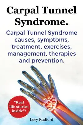 Síndrome del túnel carpiano. Síndrome del Túnel Carpiano causas, síntomas, tratamiento, ejercicios, manejo, terapias y prevención. ¡Historias de la vida real en el interior! - Carpal Tunnel Syndrome. Carpal Tunnel Syndrome causes, symptoms, treatment, exercises, management, therapies and prevention. Real Life Stories Inside!