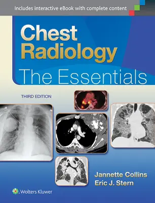 Radiología torácica: Lo esencial - Chest Radiology: The Essentials