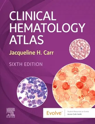 Atlas de hematología clínica (Carr Jacqueline H. (Laboratory Manager Department of Pathology and Laboratory Medicine Clarian Health Indianapolis IN)) - Clinical Hematology Atlas (Carr Jacqueline H. (Laboratory Manager Department of Pathology and Laboratory Medicine Clarian Health Indianapolis IN))