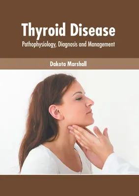 Thyroid Disease: Fisiopatología, Diagnóstico y Manejo - Thyroid Disease: Pathophysiology, Diagnosis and Management