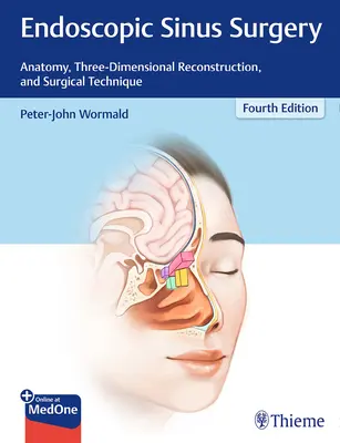 Endoscopic Sinus Surgery: Anatomía, reconstrucción tridimensional y técnica quirúrgica - Endoscopic Sinus Surgery: Anatomy, Three-Dimensional Reconstruction, and Surgical Technique