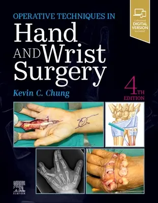 Técnicas operatorias: Cirugía de mano y muñeca - Operative Techniques: Hand and Wrist Surgery