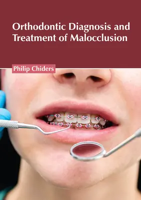 Diagnóstico y tratamiento ortodóncico de la maloclusión - Orthodontic Diagnosis and Treatment of Malocclusion