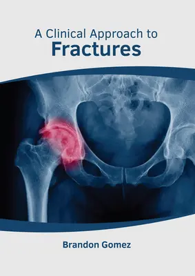 Un enfoque clínico de las fracturas - A Clinical Approach to Fractures