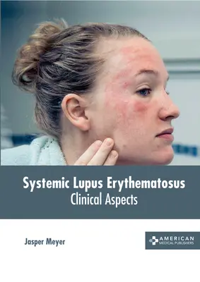 Lupus eritematoso sistémico: Aspectos clínicos - Systemic Lupus Erythematosus: Clinical Aspects