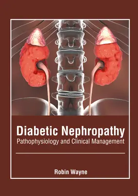 Nefropatía Diabética: Fisiopatología y manejo clínico - Diabetic Nephropathy: Pathophysiology and Clinical Management