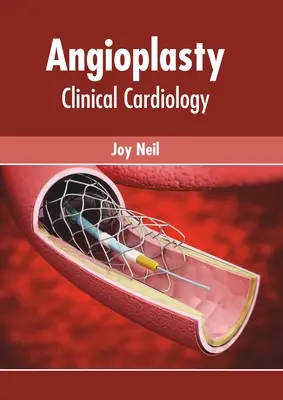 Angioplastia: Cardiología Clínica - Angioplasty: Clinical Cardiology