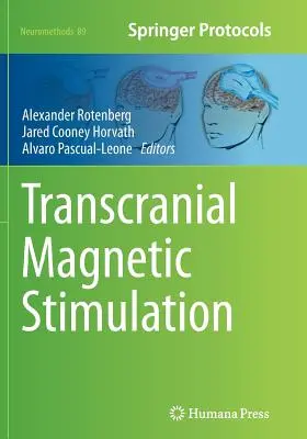 Estimulación magnética transcraneal - Transcranial Magnetic Stimulation