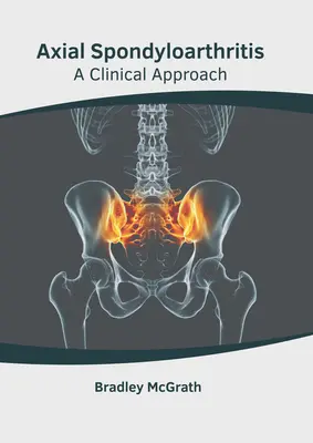 Espondiloartritis axial: A Clinical Approach - Axial Spondyloarthritis: A Clinical Approach