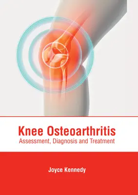 Osteoartritis de rodilla: Evaluación, diagnóstico y tratamiento - Knee Osteoarthritis: Assessment, Diagnosis and Treatment