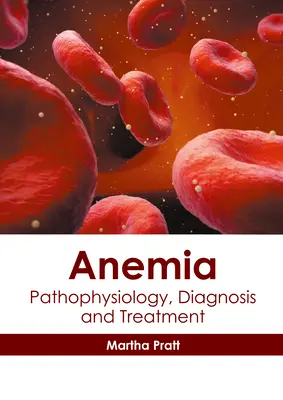 Anemia: Fisiopatología, Diagnóstico y Tratamiento - Anemia: Pathophysiology, Diagnosis and Treatment