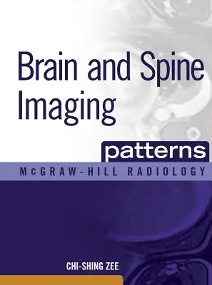 Patrones de imagen del cerebro y la columna vertebral: Imágenes del cerebro y la columna vertebral - Brain and Spine Imaging Patterns: Brain & Spine Imaging