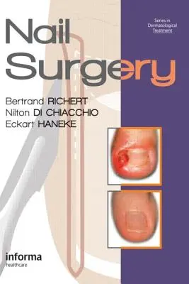 Cirugía ungueal - Nail Surgery