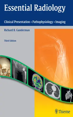 Radiología esencial: Presentación clínica - Fisiopatología - Diagnóstico por imagen - Essential Radiology: Clinical Presentation - Pathophysiology - Imaging