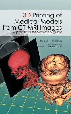 Impresión 3D de modelos médicos a partir de imágenes de TC-RM: Guía práctica paso a paso - 3D Printing of Medical Models from CT-MRI Images: A Practical step-by-step guide