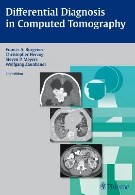 Diagnóstico diferencial en tomografía computarizada - Differential Diagnosis in Computed Tomography