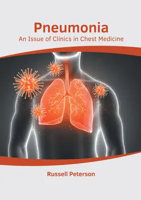 Pneumonia: Un número de Clinics in Chest Medicine - Pneumonia: An Issue of Clinics in Chest Medicine