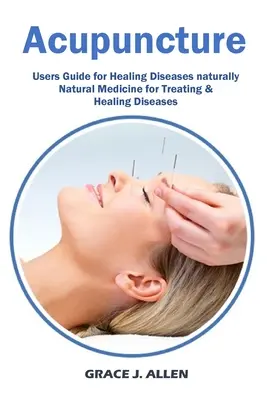 Acupuntura: Guía del usuario para curar enfermedades Medicina natural para tratar y curar enfermedades - Acupuncture: Users Guide for Healing Diseases naturally Natural Medicine for Treating & Healing Diseases