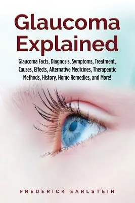 El glaucoma explicado: Datos sobre el glaucoma, Diagnóstico, Síntomas, Tratamiento, Causas, Efectos, Medicinas alternativas, Métodos terapéuticos, Historia, - Glaucoma Explained: Glaucoma Facts, Diagnosis, Symptoms, Treatment, Causes, Effects, Alternative Medicines, Therapeutic Methods, History,
