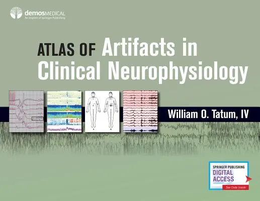 Atlas de artefactos en neurofisiología clínica - Atlas of Artifacts in Clinical Neurophysiology