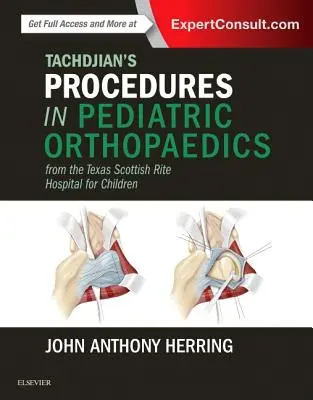 Procedimientos de Tachdjian en ortopedia pediátrica: Del Hospital Infantil Scottish Rite de Texas - Tachdjian's Procedures in Pediatric Orthopaedics: From the Texas Scottish Rite Hospital for Children