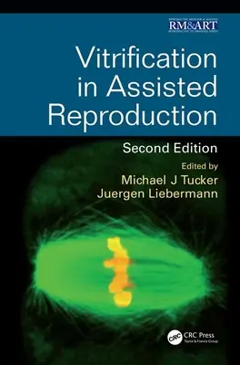 Vitrificación en reproducción asistida - Vitrification in Assisted Reproduction