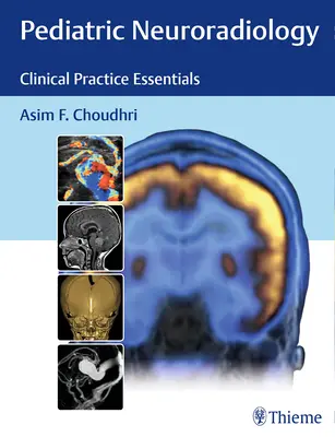 Neurorradiología pediátrica: Fundamentos de la práctica clínica - Pediatric Neuroradiology: Clinical Practice Essentials