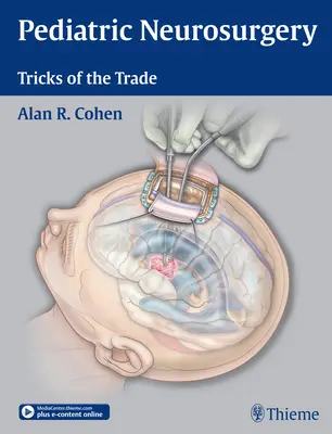 Neurocirugía pediátrica: Trucos del oficio - Pediatric Neurosurgery: Tricks of the Trade