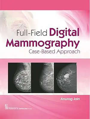 Mamografía Digital de Campo Completo: Enfoque basado en casos - Full-Field Digital Mammography: Case-Based Approach